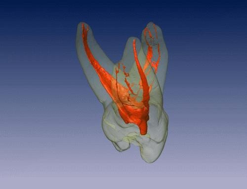 endodoncja